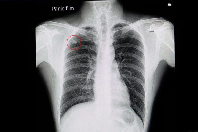 Imagem meramente ilustrativa (Banco de imagens: Shutterstock)