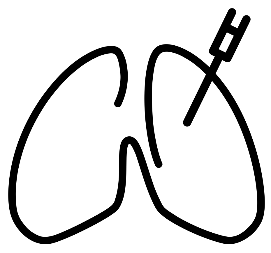 Biópsia pulmonar