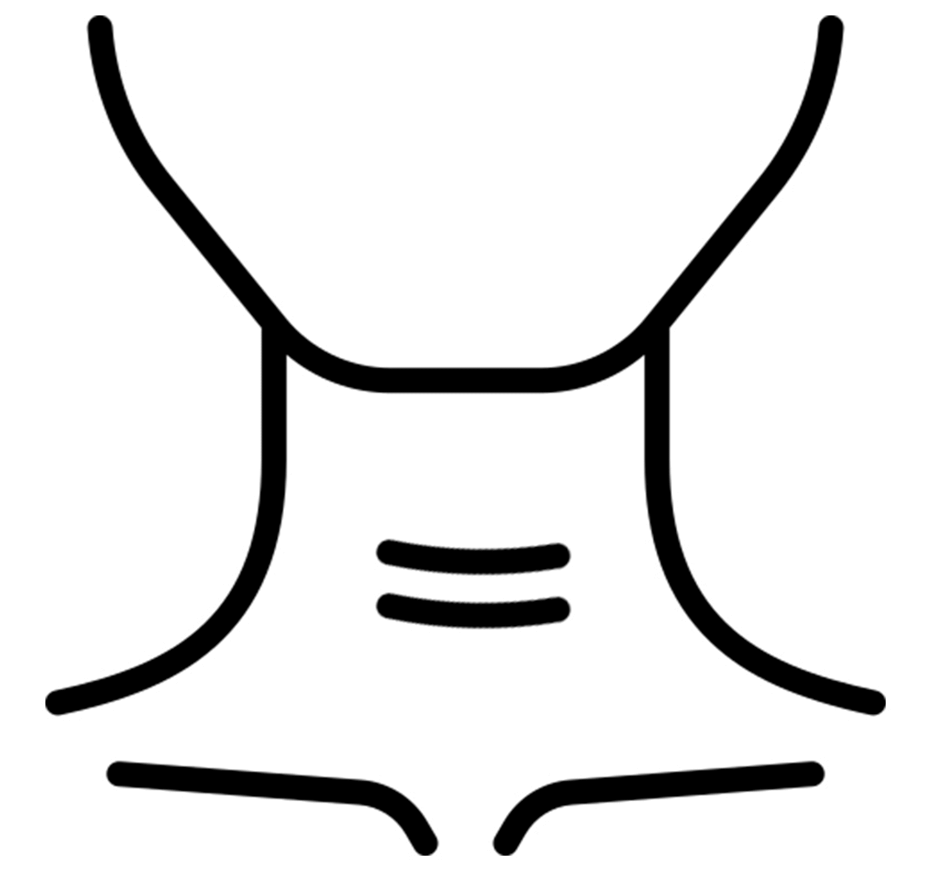 Traqueostomia