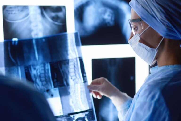 Médica segurando um raio x da região torácica