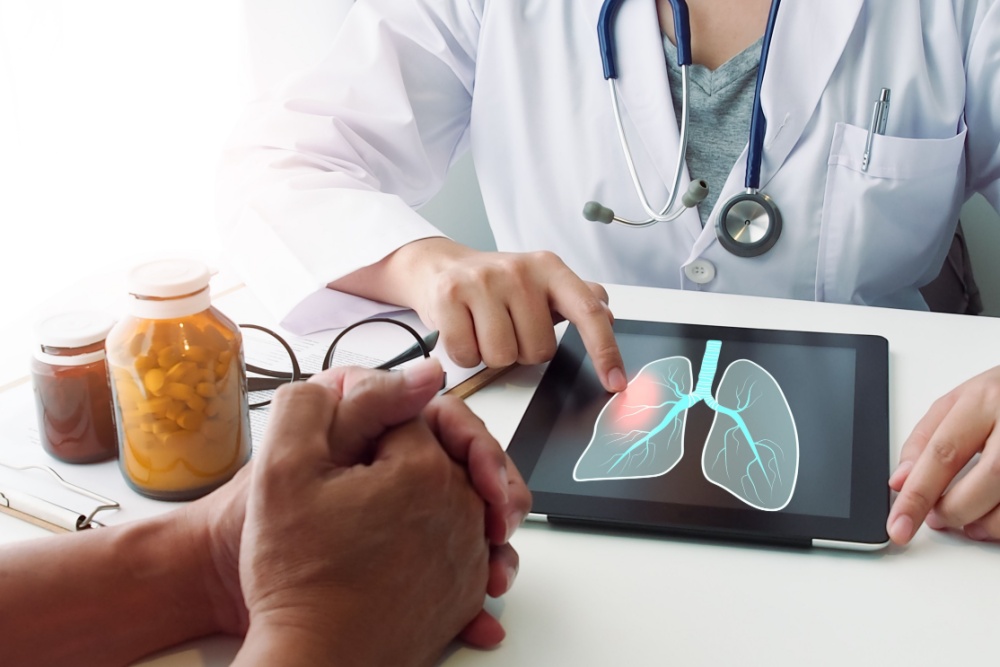 Pleuroscopia: o que é e como funciona?