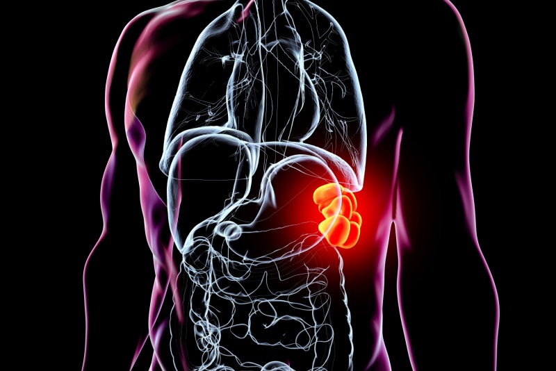 Patologias torácicas congênitas: tipos, diagnósticos e tratamentos
