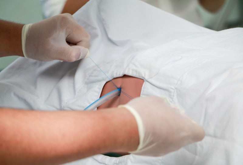 Especialista em cirurgia torácica minimamente invasiva